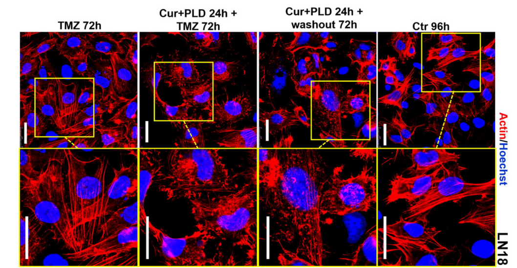 Tumore al cervello, una combinazione di molecole naturali per terapie più efficaci